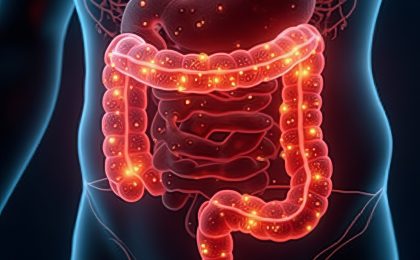 Stilisierte Darstellung eines entzündeten Darms mit Markierungen für Entzündungsherde und Mikrobiom