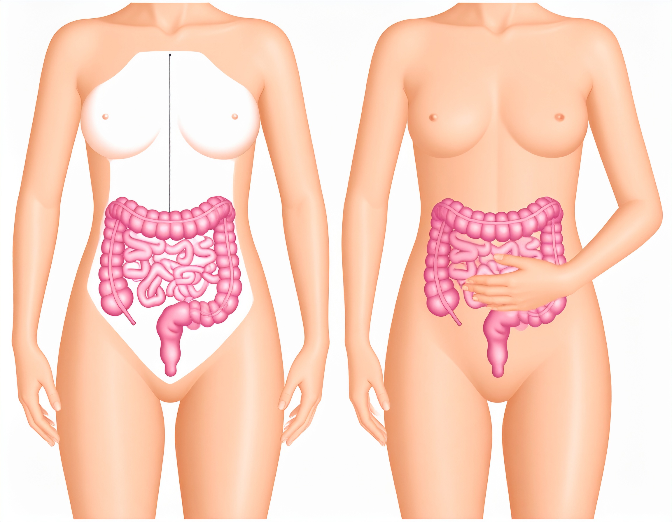 Gesund essen und trotzdem Bauchschmerzen? Ursachen & Lösungen bei SIBO